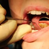 Dentist appointments drop during the pandemic