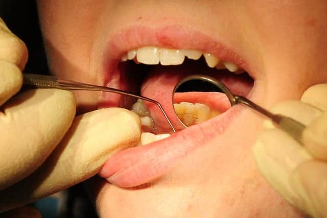 Dentist appointments drop during the pandemic