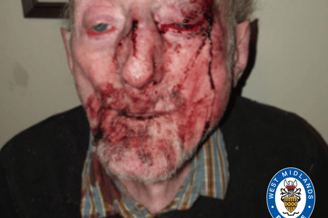 The pensioner’s family wanted police to release this image of his injuries, to show how severe McDonnell’s attack was