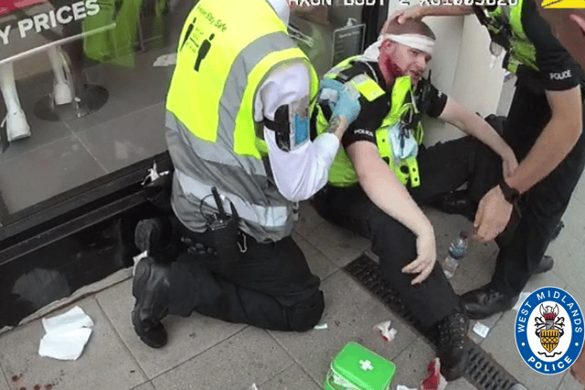 Injuries to PC James Willetts as captured on body worn video