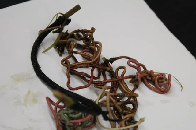 Hairbands from Hope’s intestine