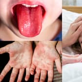 Doctors are being urged to act quickly in giving antibiotics to children with suspected Strep A symptoms (Photo: Adobe)