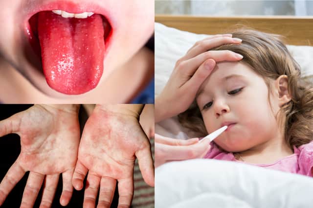 Doctors are being urged to act quickly in giving antibiotics to children with suspected Strep A symptoms (Photo: Adobe)