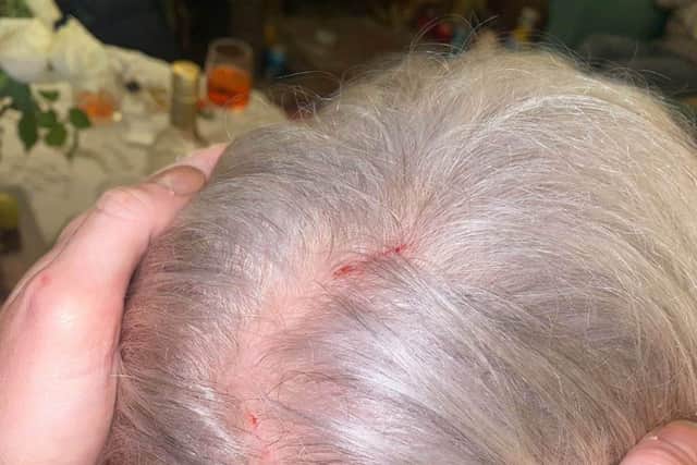 Collect. Liz Hodgkins, 72 received some marks on her head following an incident with the owl in Sedgley, West Midlands