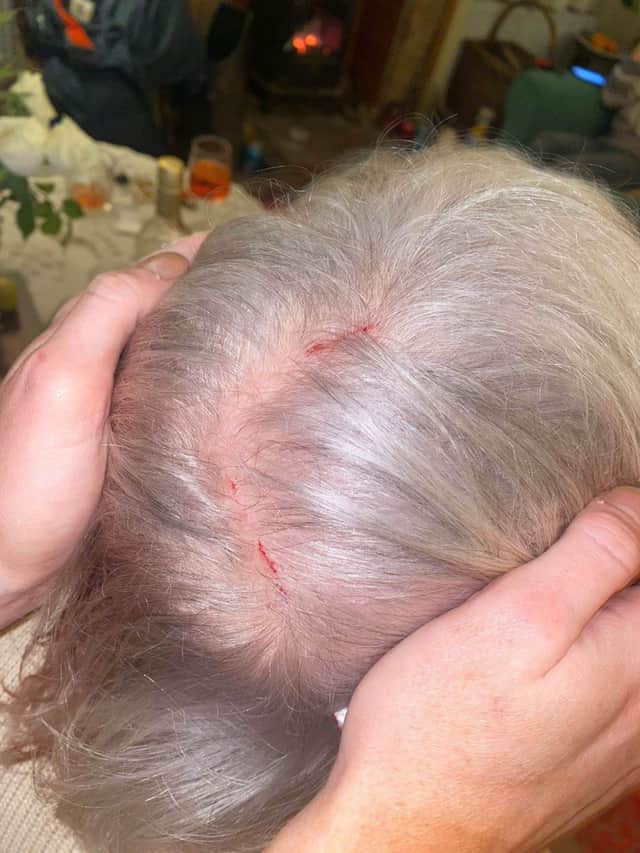 Collect. Liz Hodgkins, 72 received some marks on her head following an incident with the owl in Sedgley, West Midlands