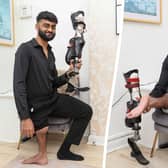 Ibrahim Abdulrauf, from Birmingham, underwent Rotationplasty after being diagnosed with bone cancer at the Royal Orthopaedic Hospital