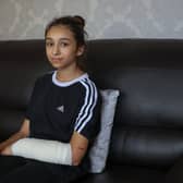 Ana Paun with her arm bandaged after being attacked by the American XL Bully dog in Bordesley Green, Birmingham