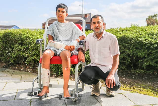 Mohammed Sami Raza displays his injuries whilst with his dad Gohar Siddique, outside Walsall Manor Hospital