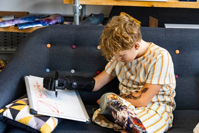 Fin Lawlor has received his new bionic arm in time for school