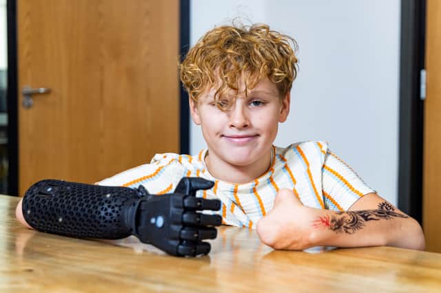 Fin Lawlor has received his new bionic arm in time for school