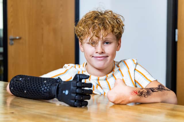 Fin Lawlor has received his new bionic arm in time for school