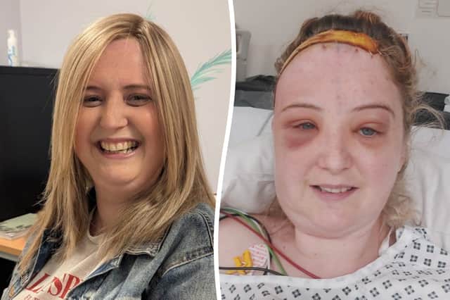 Mum's headaches put down to migraines six times by GP were tennis ball-sized tumour