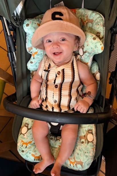 Baby Samson was diagnosed with Spina Bifida myelomeningocele