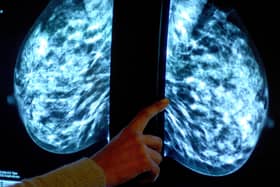 Breast cancer screenings drop 