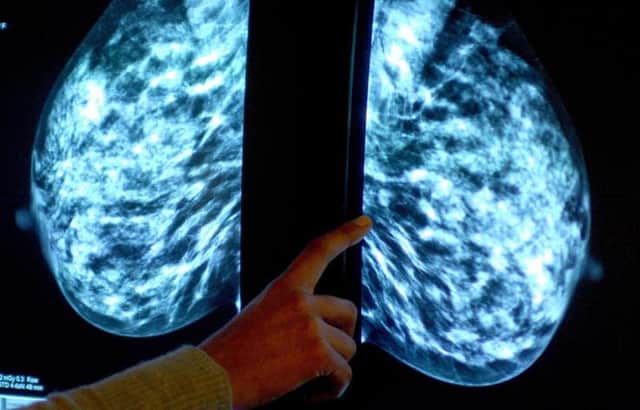 Breast cancer screening fears.